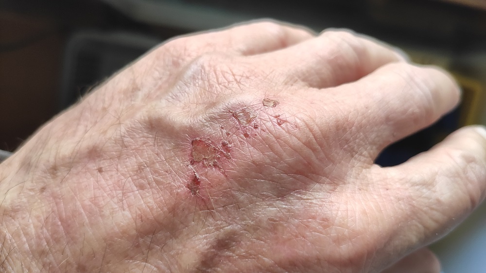 hand.jpg